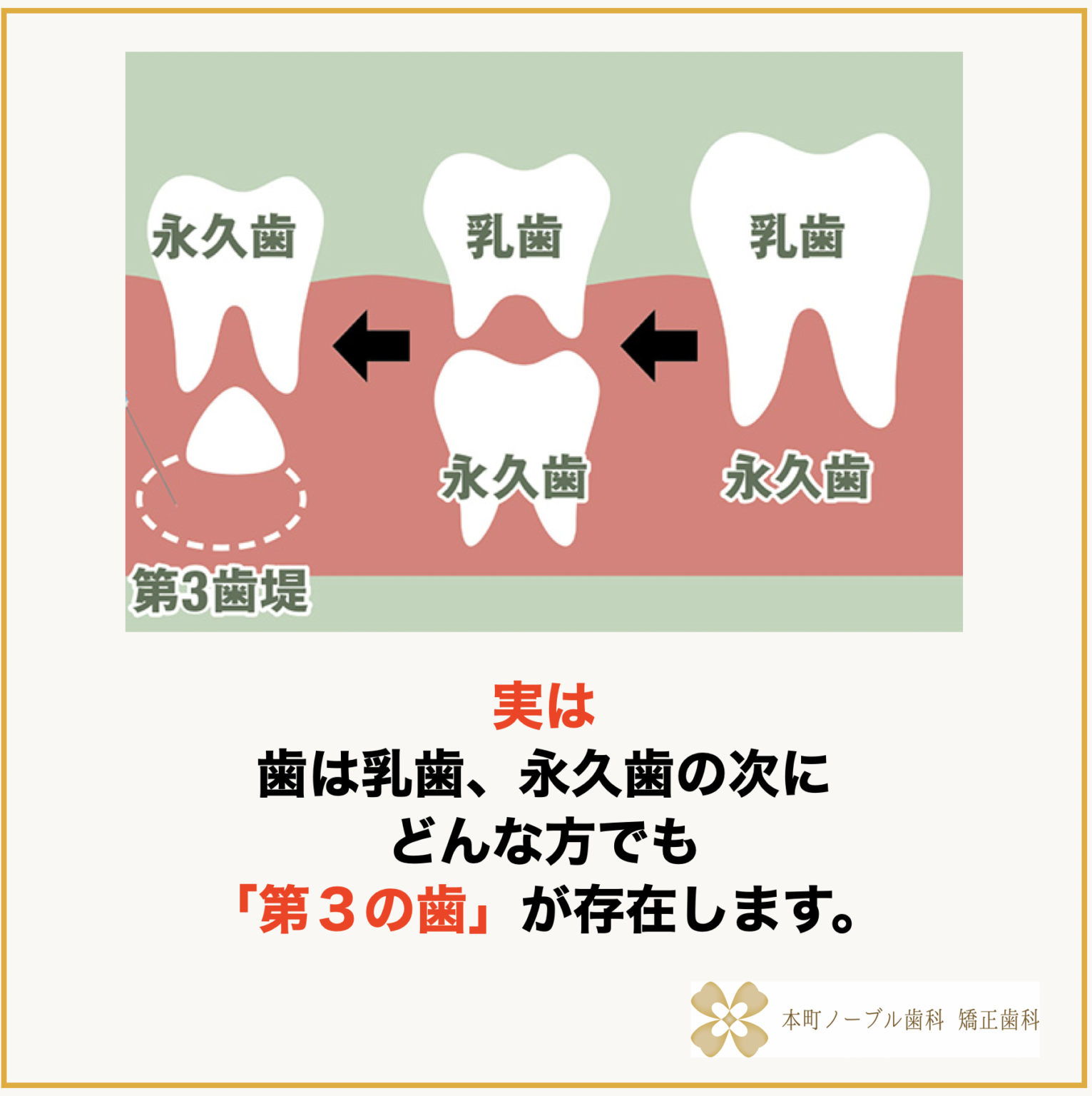 歯が生える薬『歯生え薬』について歯医者さんが分かりやすく解説! - 本町の矯正・歯科 本町ノーブル歯科 矯正歯科 歯並び・矯正無料相談 大阪 ...