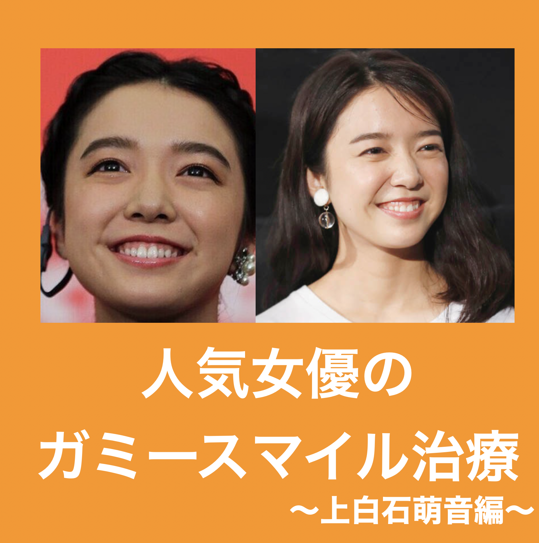 ガミー スマイル 美人