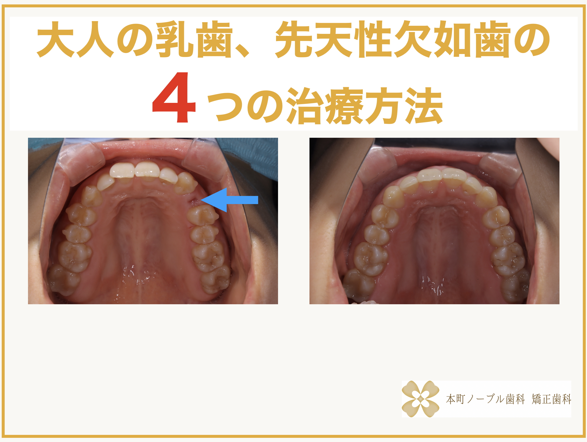 c267fba53e8639595a6075bd036d3d