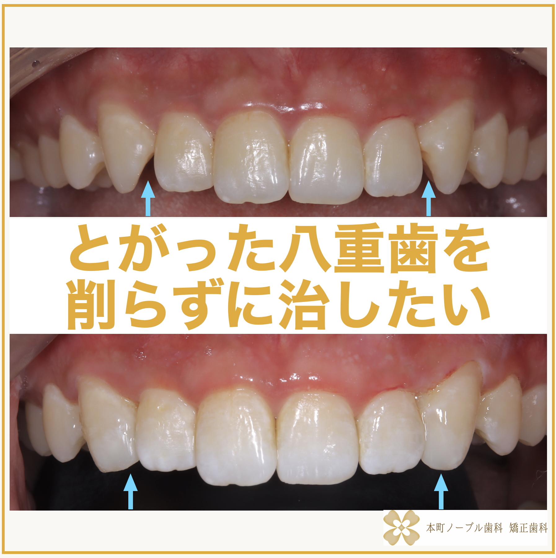 【裁断済み】再生歯科のテクニックとサイエンス 再生歯科のテクニックとサイエンス - クインテッセンス出版