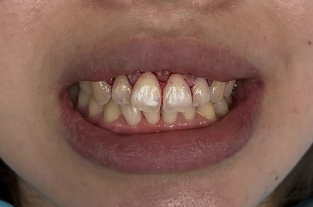after